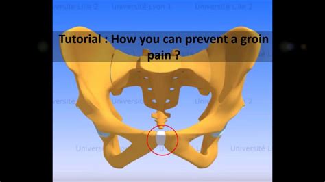 Tutorial How To Prevent Groin Pain YouTube