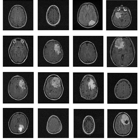 Pdf Multi Classification Of Brain Tumor Mri Images Using Deep