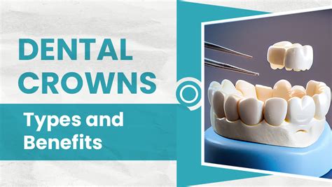 Dental Crowns Types And Benefits Poco Dental Group