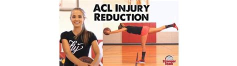 ACL Prevention Exercises