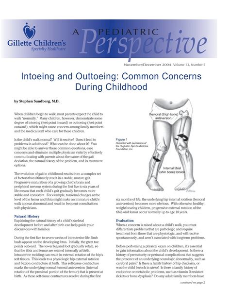 Intoeing and Outtoeing: Common Concerns During Childhood