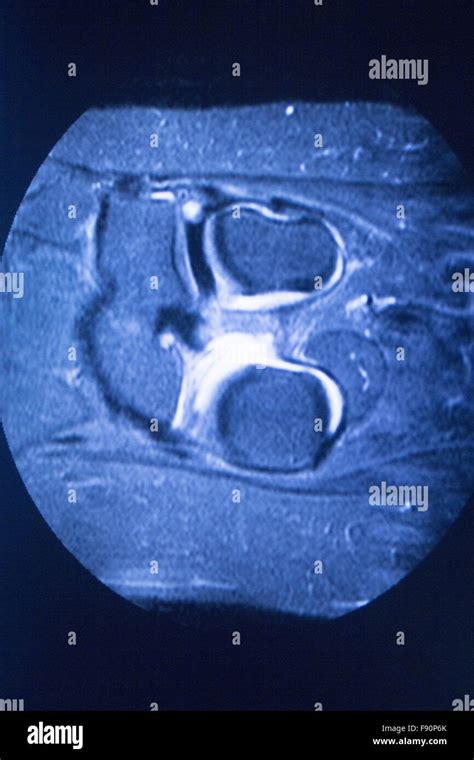 Mri Magnetic Resonance Imaging Medical Scan Test Results Showing