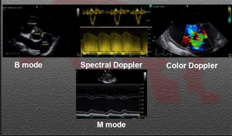 echo flashcards quizlet