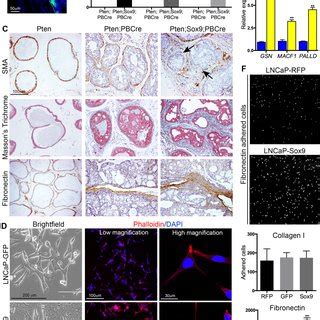 Sox Promotes Epithelial Invasion F Actin Remodelling And Adhesion To