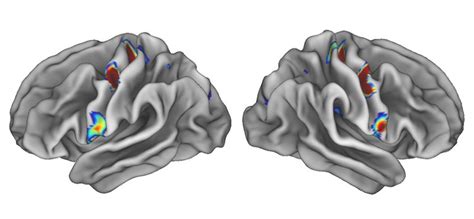 Famous ‘homunculus Brain Map Redrawn To Include Complex Movements