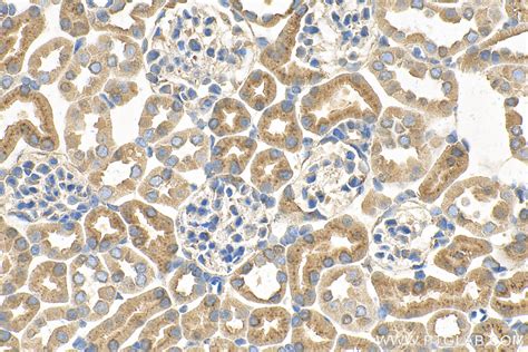 CX3CR1 antibody 66915 1 Ig Proteintech 武汉三鹰生物技术有限公司