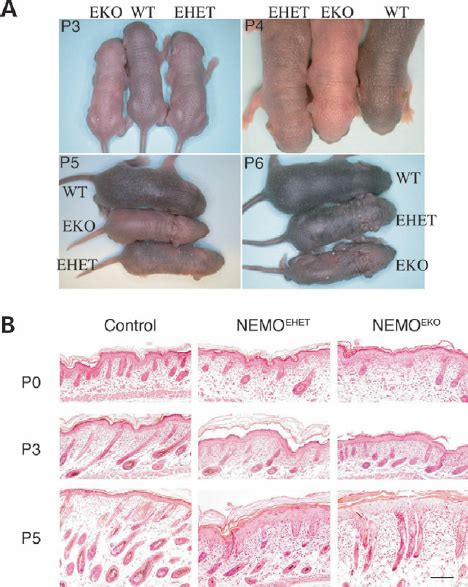 Skin Phenotype Of Mice With Epidermis Specific Deletion Of Nemo A Download Scientific