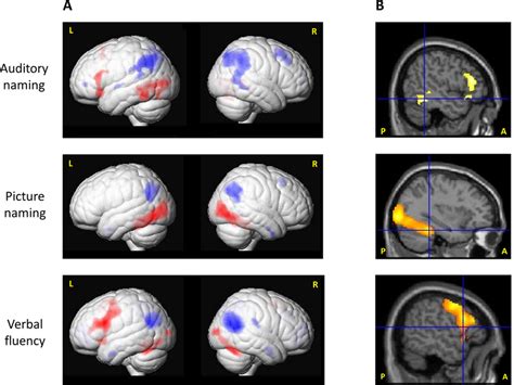 Main Fmri Activation And Deactivation A Main Activations Red And