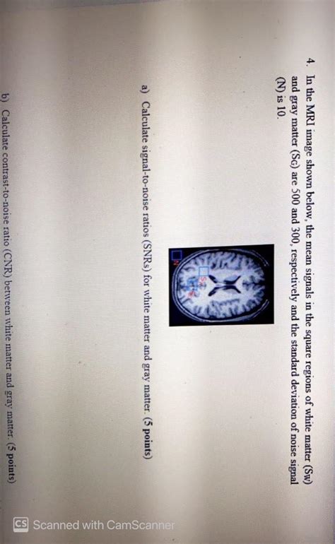 Solved 4. In the MRI image shown below, the mean signals in | Chegg.com