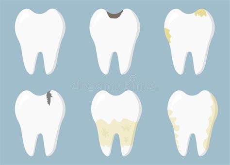 Dental Diseases Tooth Decay Inflammation Dental Plaque Periodontal