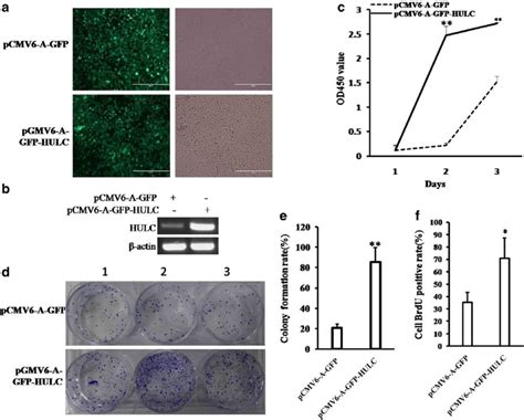 Hulc Promotes Liver Cancer Cell Growth In Vitro A The Photography Of