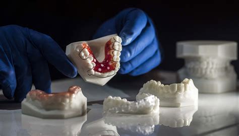 La impresión 3D en la odontología cómo está revolucionando este