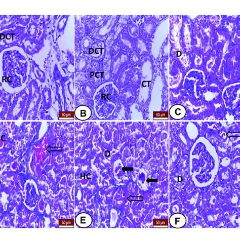 Immunohistochemical Staining Of Ck In Hepatic Sections From All