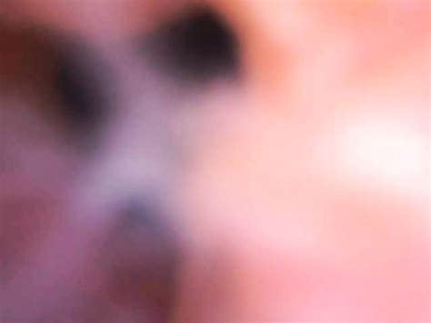 Look Inside Bladder And Prostate With Endoscope Japanese Gay Asian Porn XHamster