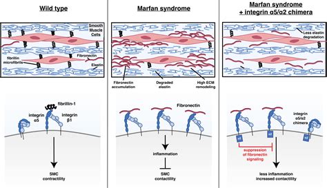 Fn Fibronectin Integrin Signaling Promotes Thoracic Aortic