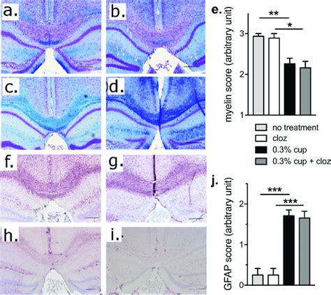 Clozapine Did Not Prevent Demyelination Or Alter Astrocyte Activation