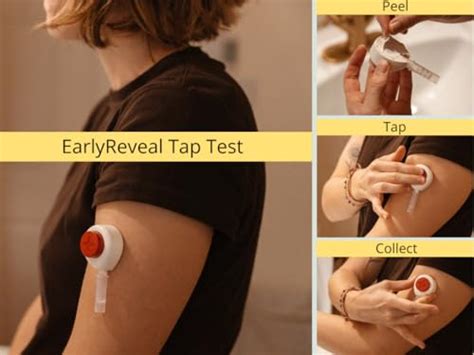 EarlyReveal Kit de test ADN du robinet Détection précoce du sexe