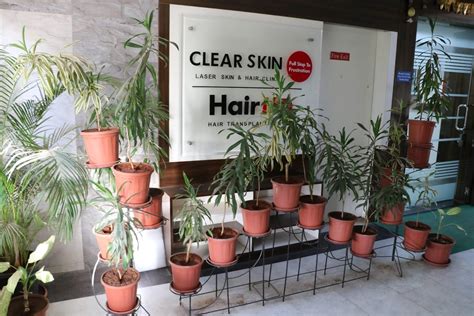 Clear Skin Pimple Saudagar Skin Clinic In Pune Pimple Treatment