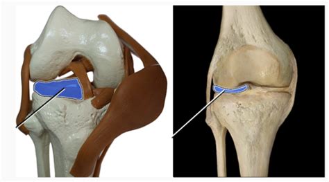 KneeJoint_Ligaments Flashcards | Quizlet