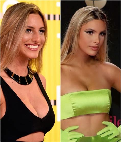 Lele Pons Antes Y Después Cómo Lucía La Influencer Venezolana Antes De Operarse La Nariz