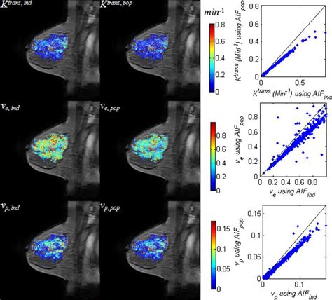 Parametric Maps Overlaid On A T 1 Weighted Image For Patient 6 The