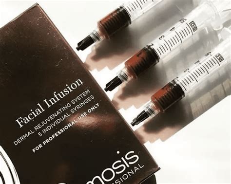 Osmosis RevitaPen Infusion Facial Leeds Medifine Skin Clinic