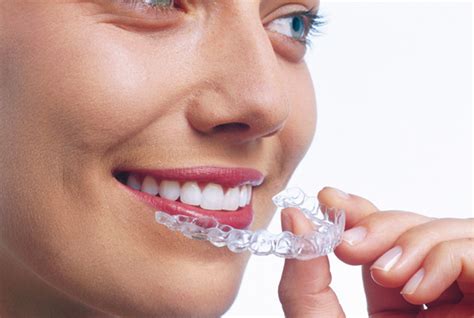 Cómo limpiar y cuidar los alineadores invisibles Invisalign