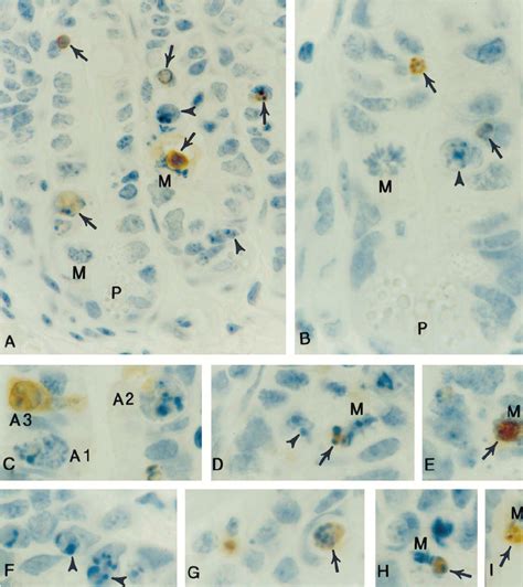 The Morphology Of Apoptotic Cells From The Small Intestinal Crypts Of A