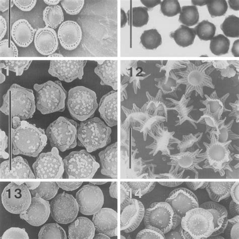 Emericella Miyajii Cbm Fa Asci Ascospores Lm