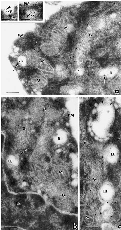 Immunoelectron Microscopic Analysis Of Eps15 Redistribution During Egfr