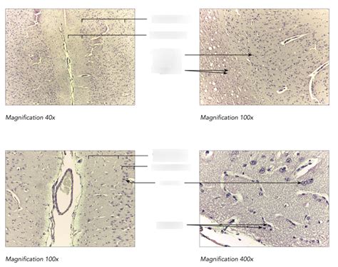 Lab Exam Histology Cerebrum Diagram Quizlet