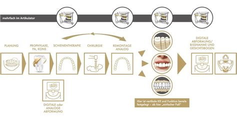 Behandlungsplanung M Nchen Zahnarzt F Nf H Fe