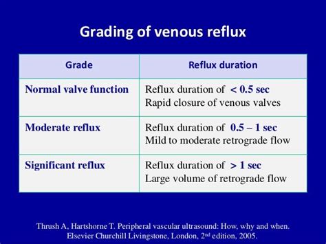 Doppler ultrasound of normal venous flow