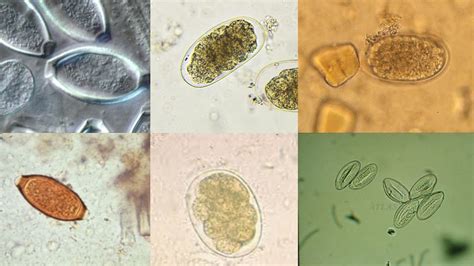 Clinical Parasitology Laboratory Intestinal Nematode Egg Identification Youtube