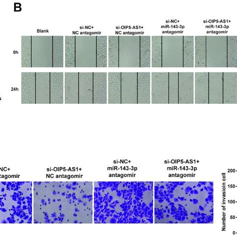 OIP5 AS1 Facilitates The Invasion Migration And Proliferation Of