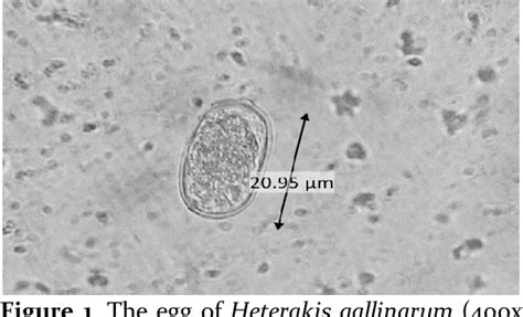 PREVALENCE OF DIGESTIVE ENDOPARASITES HELMINTH AND PROTOZOA IN PIGEON