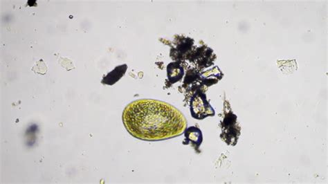 Different Freshwater Species Of Protozoa Single Cell Organisms As Stentors, Ciliates And Algae ...