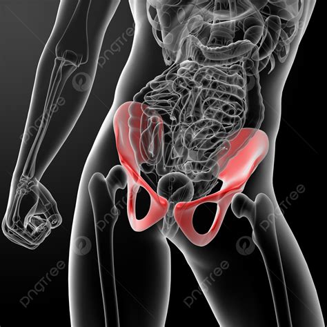 Fundo D Render Pelve Sob Os Resultados Do Leo Do Radiologista De