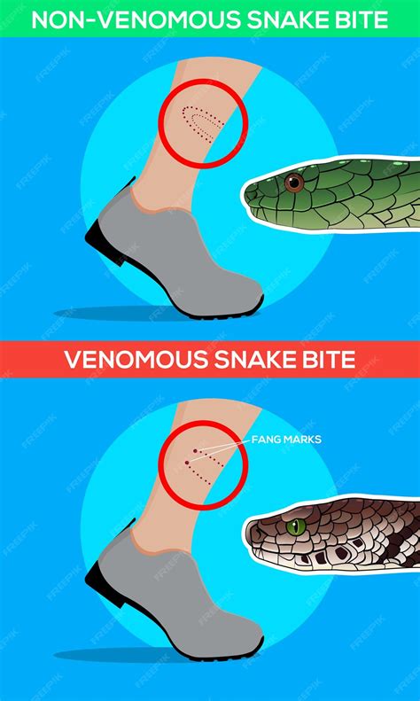 Premium Vector | Venomous and non venomous snake bite in the leg