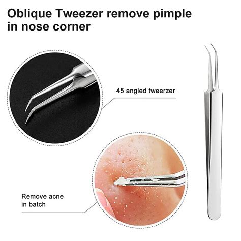 Professional Facial Blackhead Remover Buy 1 Get 1 FREE – The find spot