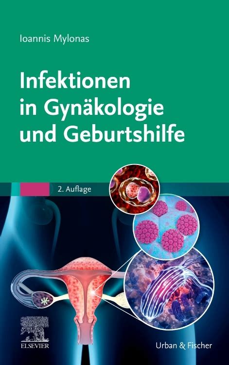 Infektionen in Gynäkologie und Geburtshilfe von Ioannis Mylonas ISBN