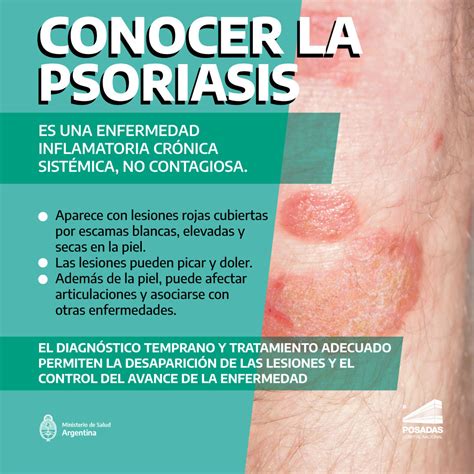 Psoriasis Argentina Gob Ar