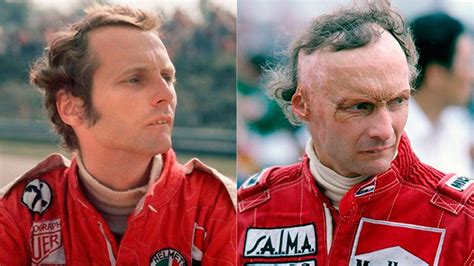 A 45 Años Del Accidente De Niki Lauda En Nürburgring Que Marcó Para