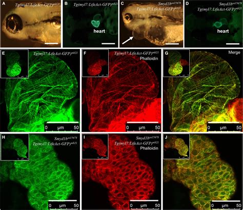 Frontiers Overexpression Of Lifeact Gfp Disrupts F Actin Organization