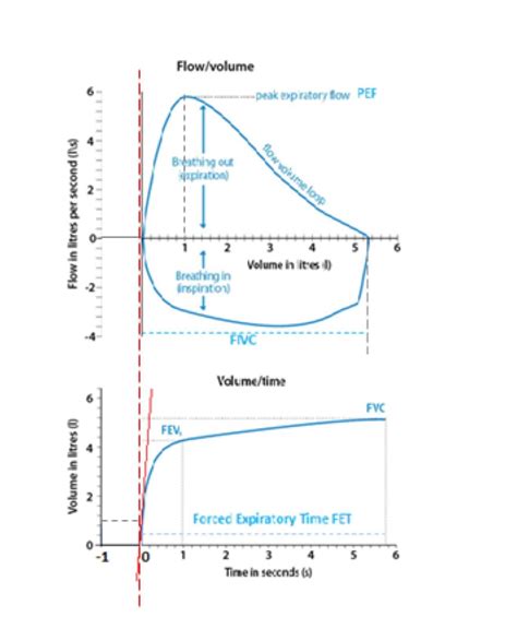 Fvc1 Spirometry At Harry Rutter Blog