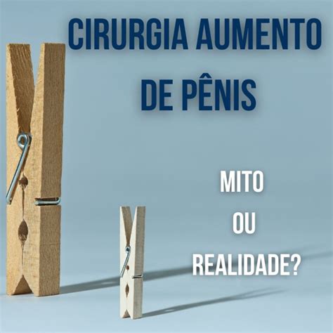 Cirurgia Para Aumento De Pênis Mito Ou Realidade Dr Paulo Esteves