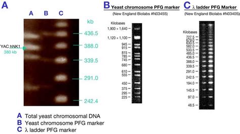 Pulse Field Gel Pfg Electrophoresis Of A Yeast Artificial Chromosome