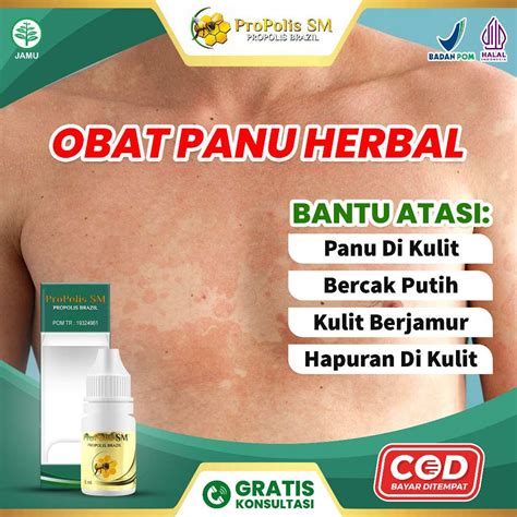 Jual Propolis Sm Obat Herbal 100 Original Atasi Penyakit Kulit Obat