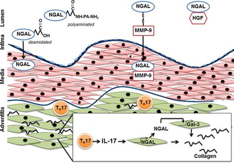 The Central Role Of Neutrophil Gelatinaseassociated Lipocalin In