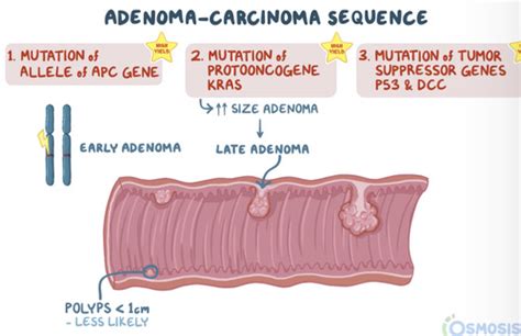 Colon Cancer Flashcards Quizlet